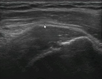 RhMSUS Question 8